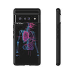 Neon Anatomical Skeleton Phone Case | Internal Displacement Art