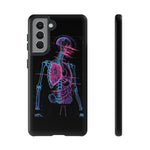 Neon Anatomical Skeleton Phone Case | Internal Displacement Art